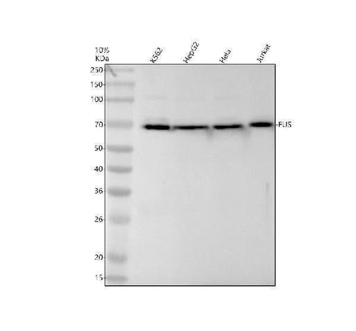 Anti-FUS / TLS Rabbit Monoclonal Antibody Boster Bio