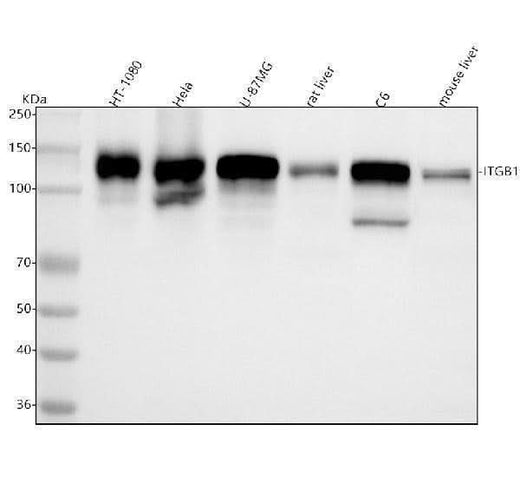 Anti-Integrin beta 1 ITGB1 Rabbit Monoclonal Antibody Boster Bio