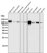 Anti-Integrin beta 1 ITGB1 Rabbit Monoclonal Antibody Boster Bio