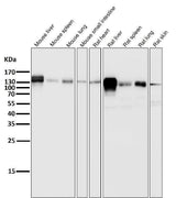 Anti-Integrin beta 1 ITGB1 Rabbit Monoclonal Antibody Boster Bio