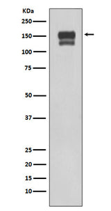 Anti-Integrin beta 1 ITGB1 Rabbit Monoclonal Antibody Boster Bio