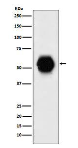 Anti-Gata6 Rabbit Monoclonal Antibody Boster Bio