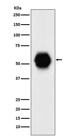 Anti-Gata6 Rabbit Monoclonal Antibody Boster Bio