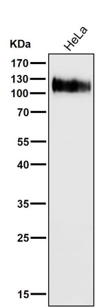 Anti-LAMP1/Cd107A Rabbit Monoclonal Antibody Boster Bio