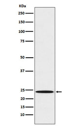 Anti-Mad2L1 Rabbit Monoclonal Antibody Boster Bio