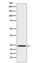 Anti-Mad2L1 Rabbit Monoclonal Antibody Boster Bio