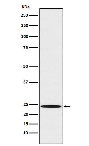 Anti-Mad2L1 Rabbit Monoclonal Antibody Boster Bio
