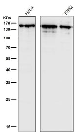 Anti-Collagen III Rabbit Monoclonal Antibody Boster Bio