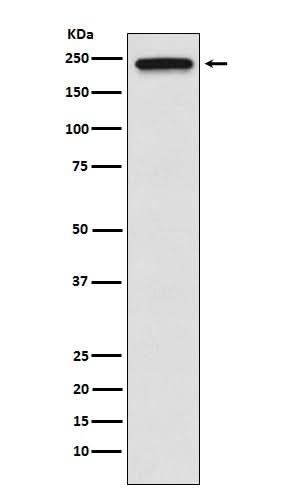 Anti-TRPM7 Monoclonal Antibody Boster Bio