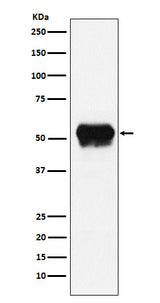 Anti-Fibrinogen gamma chain Rabbit Monoclonal Antibody Boster Bio