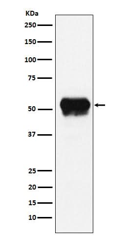 Anti-Fibrinogen gamma chain Rabbit Monoclonal Antibody Boster Bio