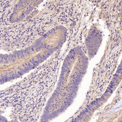 Anti-GSK3 beta Rabbit Monoclonal Antibody Boster Bio