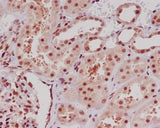 Anti-ERG Rabbit Monoclonal Antibody Boster Bio
