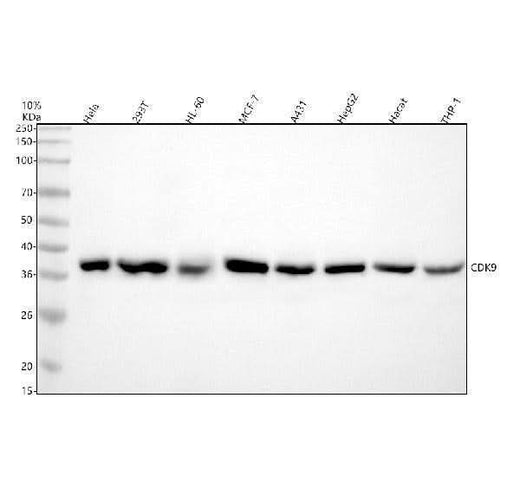 Anti-CDK9 Rabbit Monoclonal Antibody Boster Bio