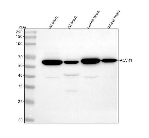 Anti-ACVR1 Rabbit Monoclonal Antibody Boster Bio