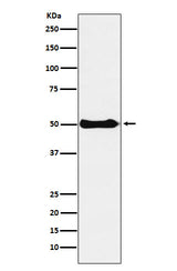 Anti-CSK Rabbit Monoclonal Antibody Boster Bio