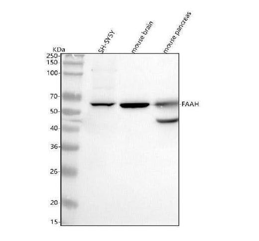 Anti-FAAH1 Rabbit Monoclonal Antibody Boster Bio