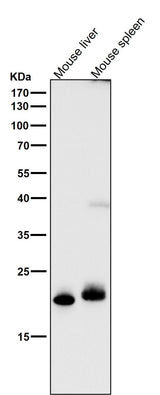 Anti-FGF21 Rabbit Monoclonal Antibody Boster Bio