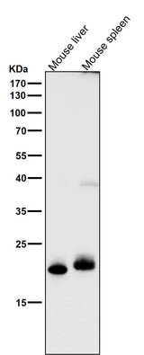 Anti-FGF21 Rabbit Monoclonal Antibody Boster Bio