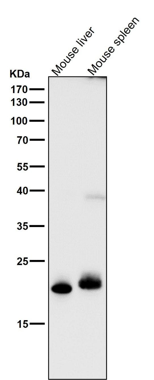 Anti-FGF21 Rabbit Monoclonal Antibody Boster Bio