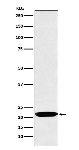 Anti-Oncostatin M Rabbit Monoclonal Antibody Boster Bio