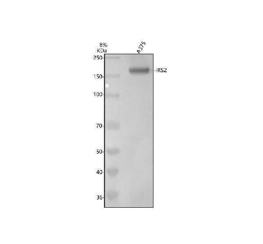 Anti-IRS2 Rabbit Monoclonal Antibody Boster Bio