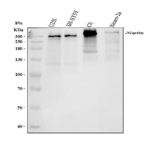 Anti-Nestin Rabbit Monoclonal Antibody Boster Bio