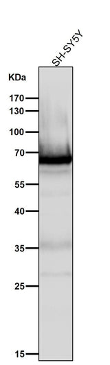 Anti-COX1 PTGS1 Rabbit Monoclonal Antibody Boster Bio