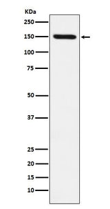 Anti-CD163 Rabbit Monoclonal Antibody Boster Bio