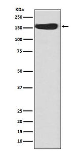 Anti-CD163 Rabbit Monoclonal Antibody Boster Bio