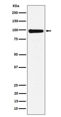 Anti-CHM Rabbit Monoclonal Antibody Boster Bio