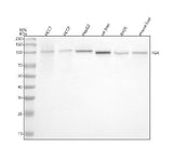 Anti-Fibrinogen alpha chain Rabbit Monoclonal Antibody Boster Bio