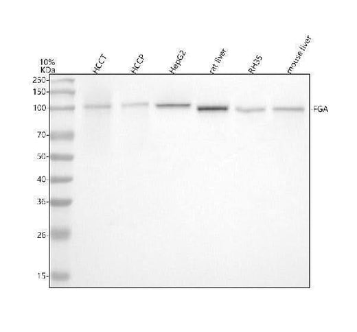 Anti-Fibrinogen alpha chain Rabbit Monoclonal Antibody Boster Bio