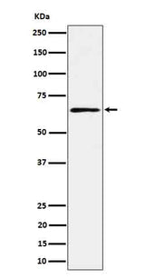 Anti-RIP2 Rabbit Monoclonal Antibody Boster Bio