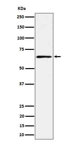 Anti-RIP2 Rabbit Monoclonal Antibody Boster Bio