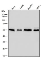 Anti-Apg12(Atg12) Rabbit Monoclonal Antibody Boster Bio