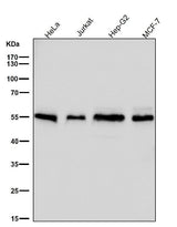 Anti-Apg12(Atg12) Rabbit Monoclonal Antibody Boster Bio