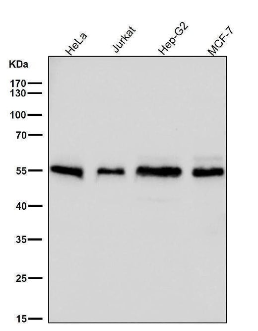 Anti-Apg12(Atg12) Rabbit Monoclonal Antibody Boster Bio