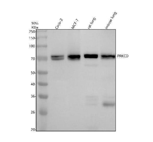 Anti-PKC delta + PKC theta Rabbit Monoclonal Antibody Boster Bio