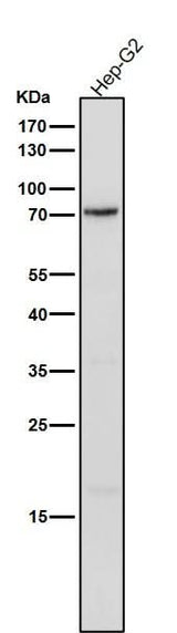 Anti-Phospho-PKC delta (Y311) Rabbit Monoclonal Antibody Boster Bio