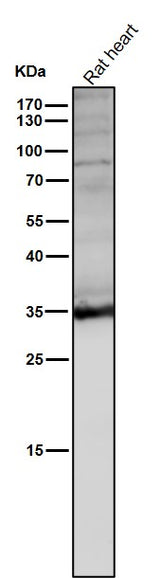 Anti-LDHA Rabbit Monoclonal Antibody Boster Bio