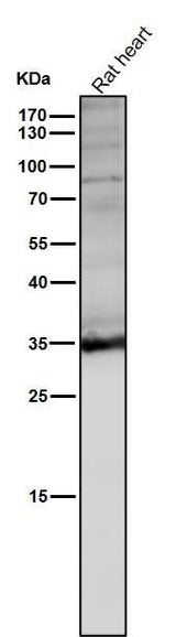 Anti-LDHA Rabbit Monoclonal Antibody Boster Bio