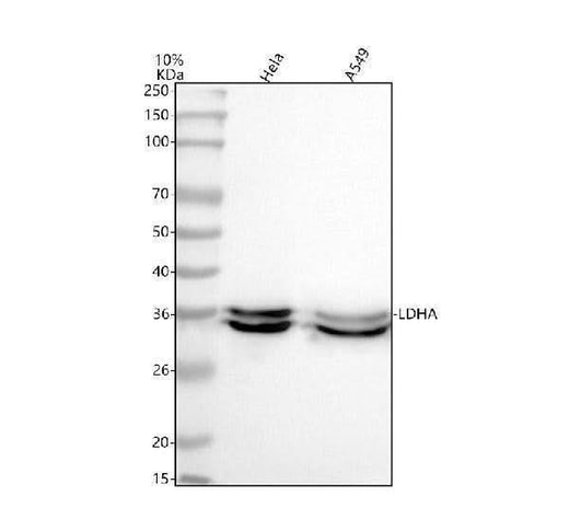 Anti-Lactate Dehydrogenase LDHA Rabbit Monoclonal Antibody Boster Bio