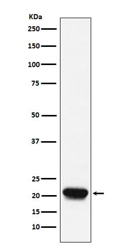 Anti-RHEB Rabbit Monoclonal Antibody Boster Bio