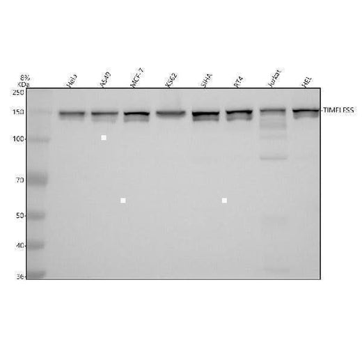 Anti-Timeless Rabbit Monoclonal Antibody Boster Bio