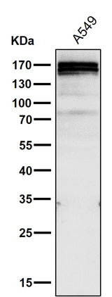 Anti-RelB Rabbit Monoclonal Antibody Boster Bio