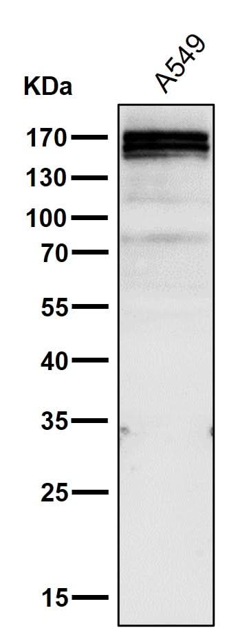 Anti-RelB Rabbit Monoclonal Antibody Boster Bio