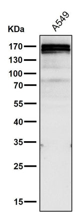 Anti-RelB Rabbit Monoclonal Antibody Boster Bio