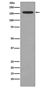 Anti-KMT4 / Dot1L Rabbit Monoclonal Antibody Boster Bio