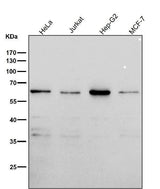 Anti-PAX7 Rabbit Monoclonal Antibody Boster Bio
